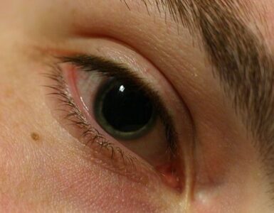 Primer plano de una Pupila dilatada para una noche de MDMA en Berlín