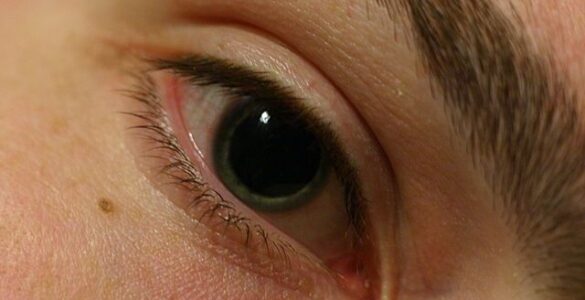 Primer plano de una Pupila dilatada para una noche de MDMA en Berlín